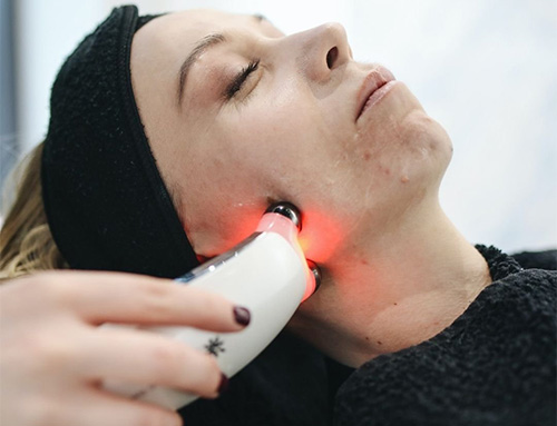 laser and skin rejuvenation