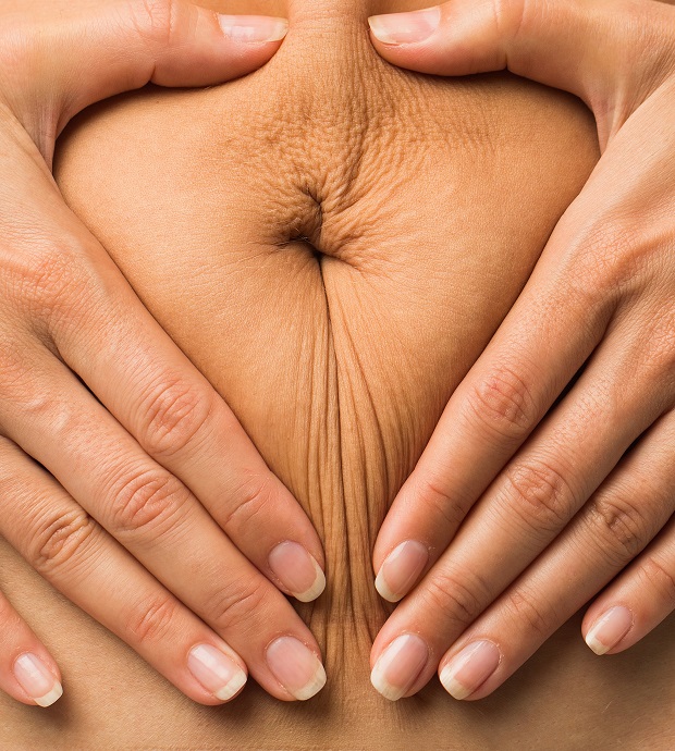 Renuvion Skin Tightening Nashville, TN