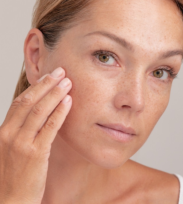 Hyperpigmentation Care Nashville