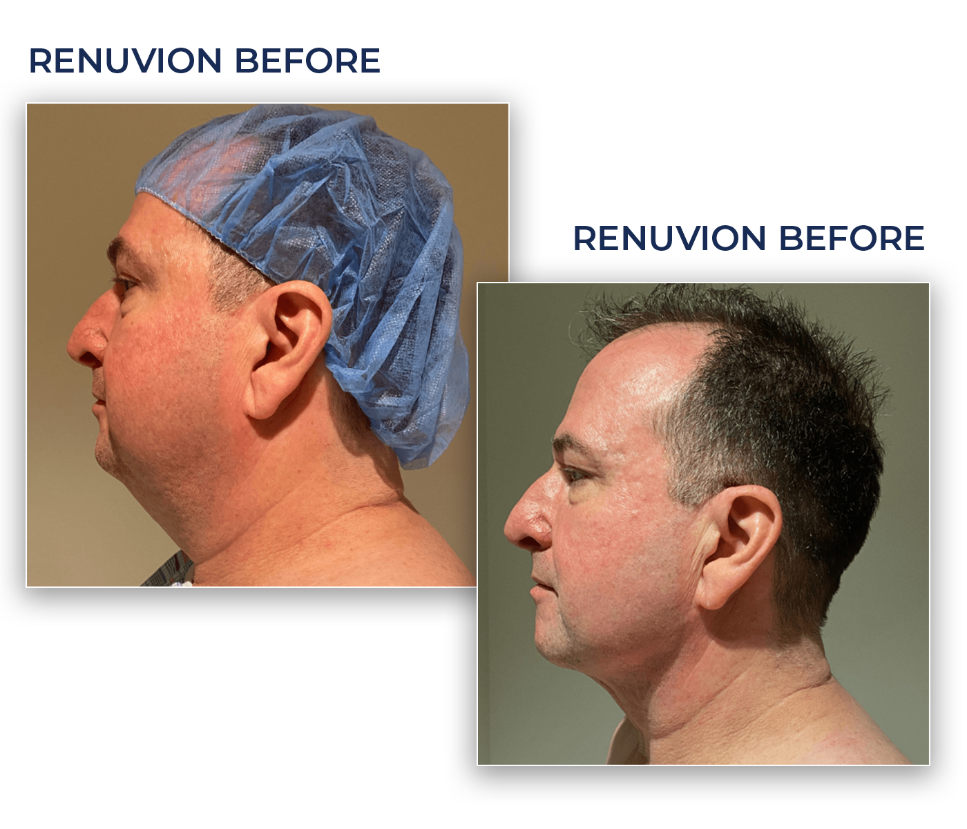 skin rejuv b&A skin rejuv b&A