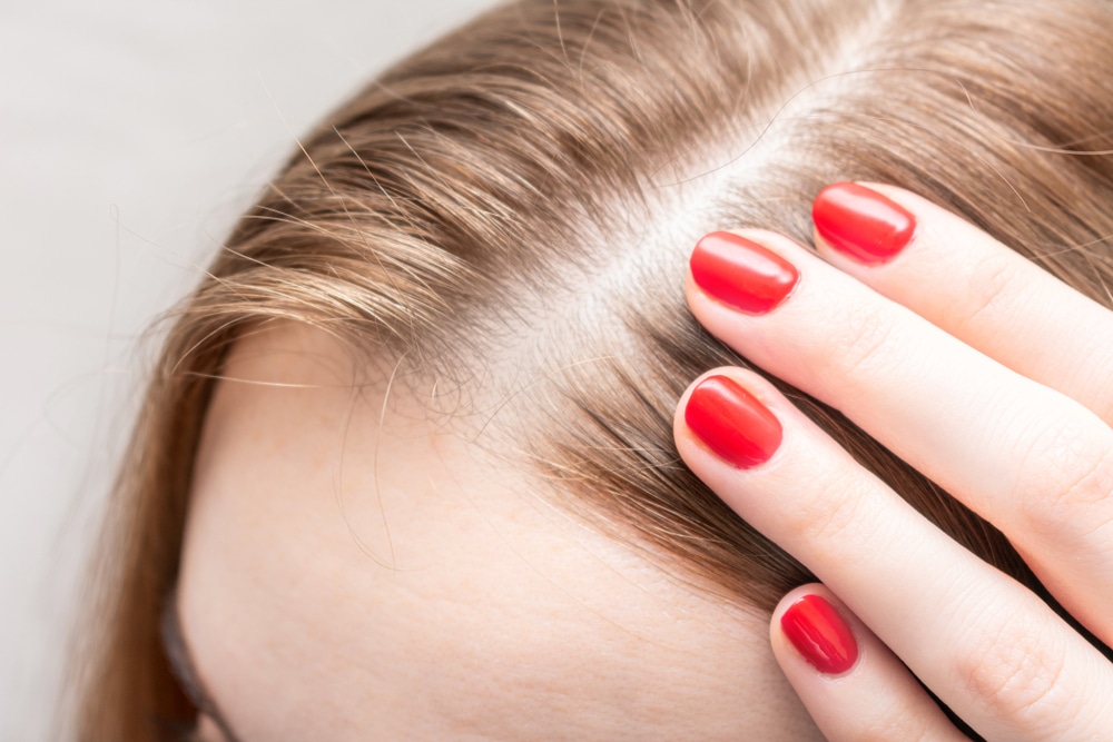 Blonde woman's scalp, revealing a widening part