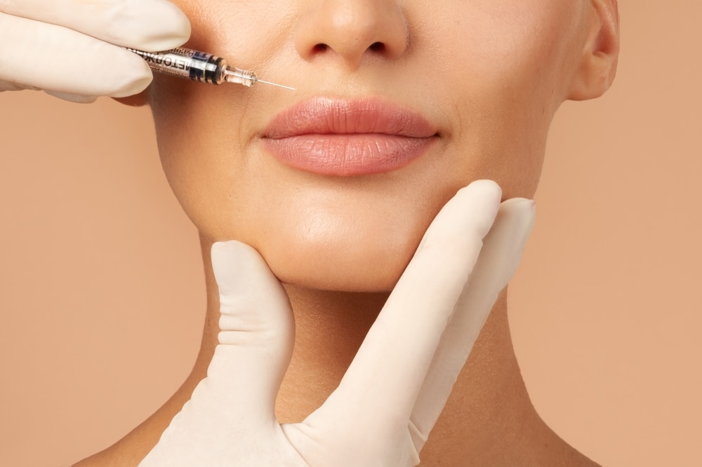 Injector places dermal filler in a woman's lips