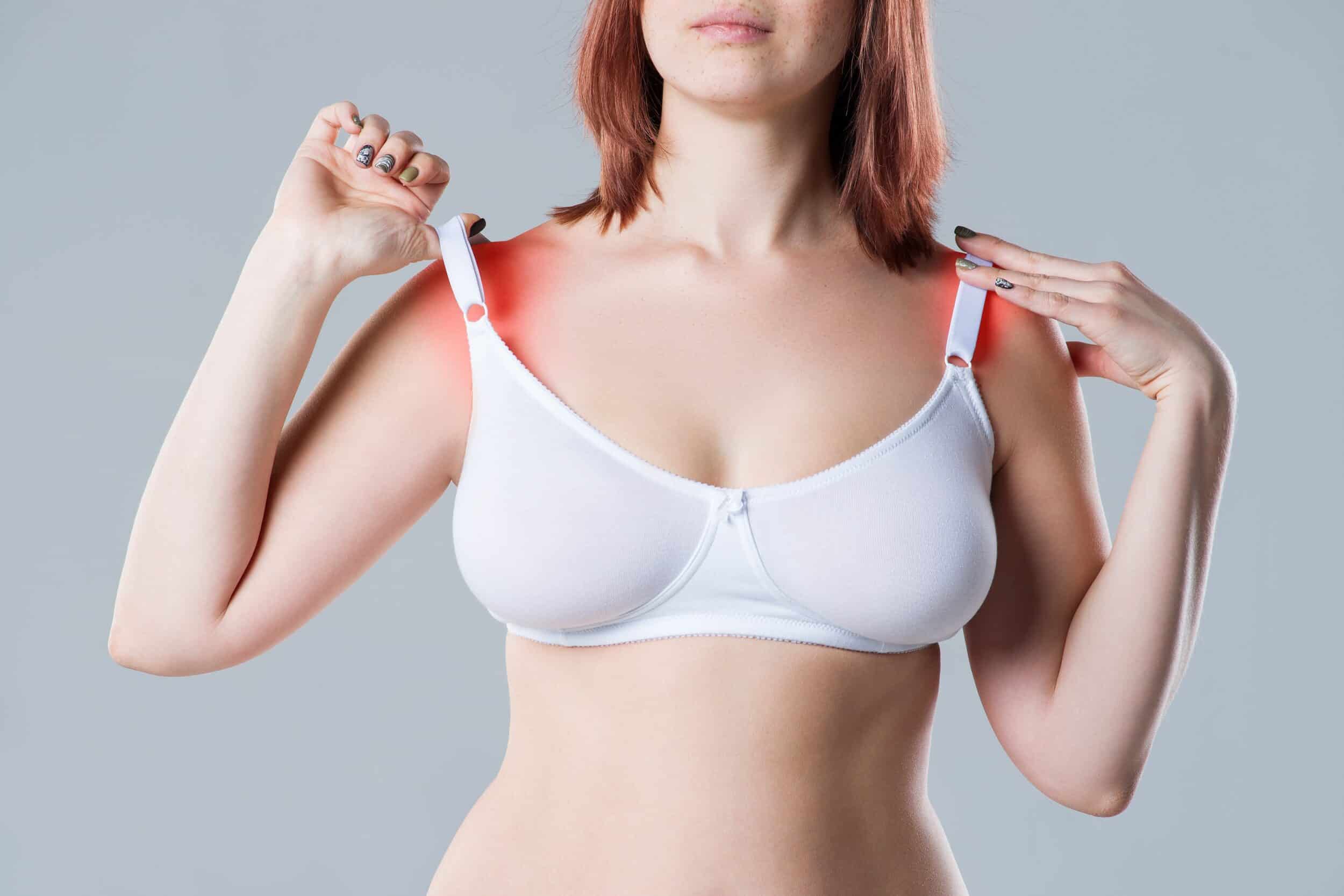 Woman lifts the straps of her bra, showing intense irritation and shoulder grooves from heavy breasts, before a breast reduction