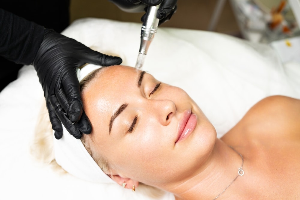 Woman during her RF microneedling session to rejuvenate skin